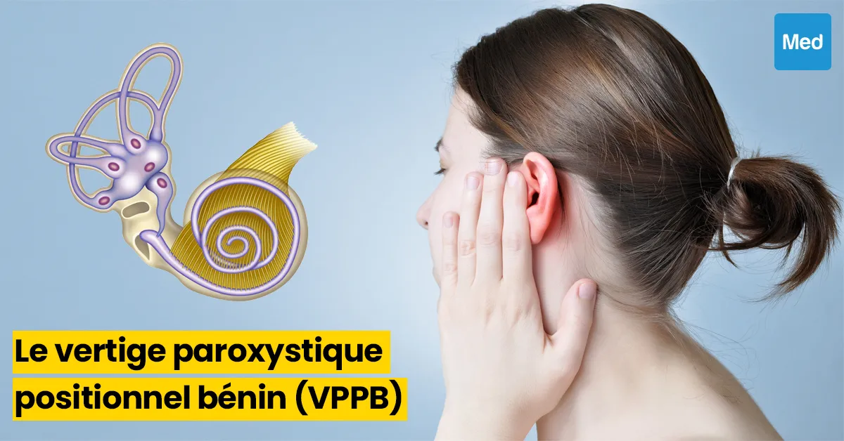 Le Vertige Paroxystique Positionnel Bénin (VPPB)